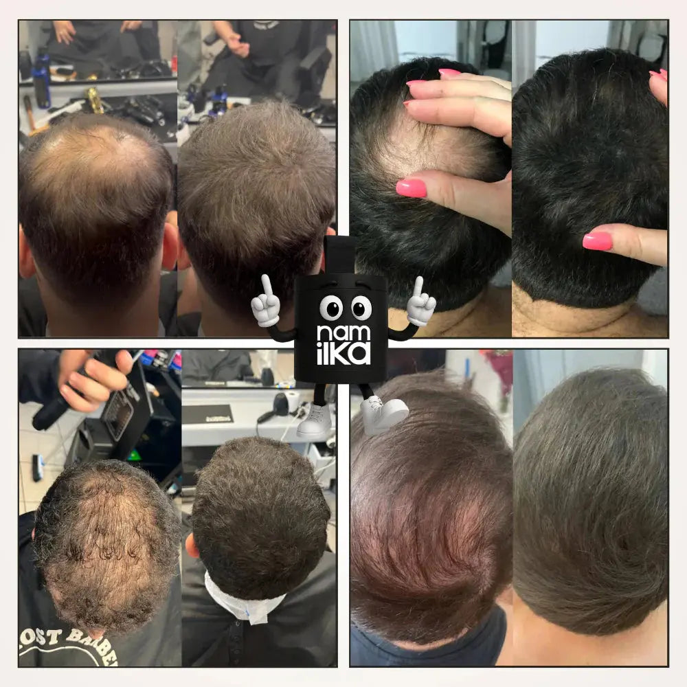 Namka™ – le Camouflage Capillaire qui vous rajeunit. Namilka