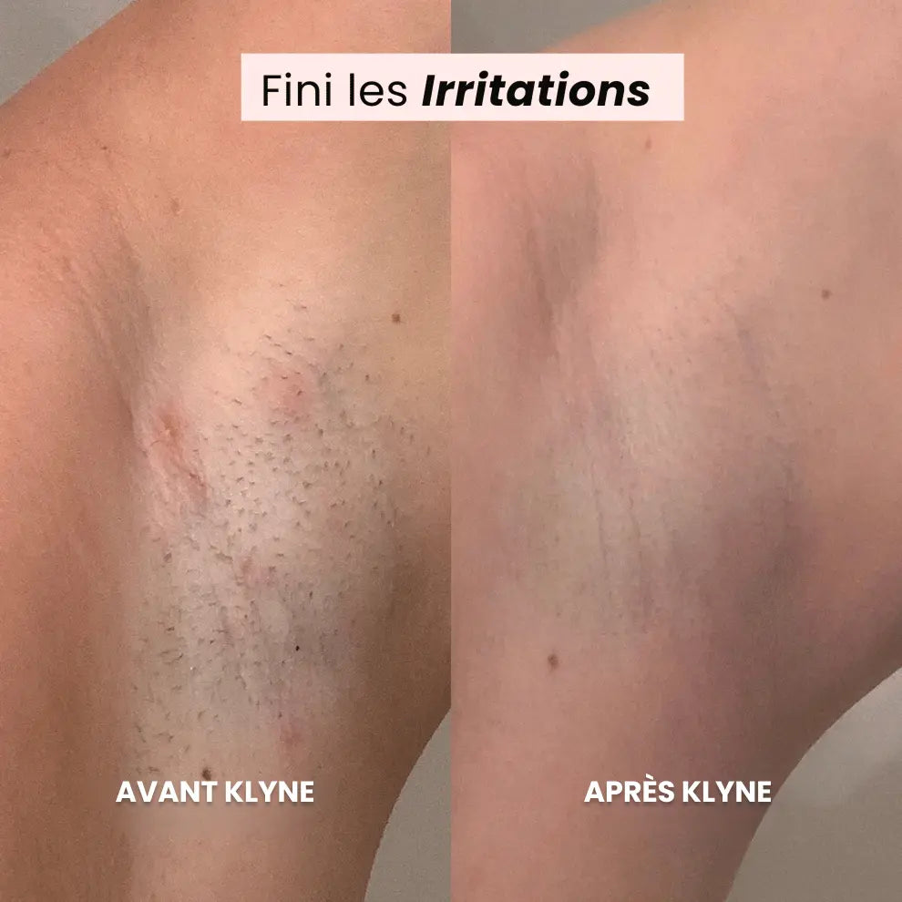 Rasoir KLYNE® Klyne